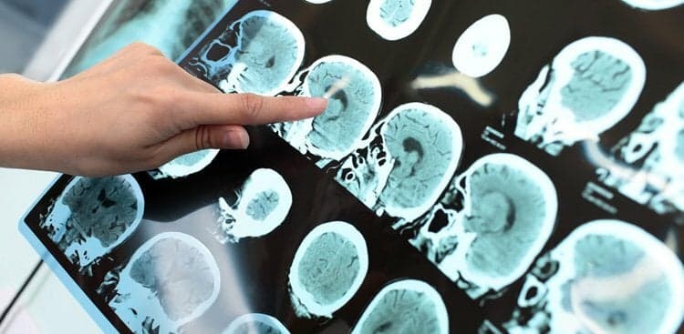 3 Key Signs You’re Too Smart for Your Job